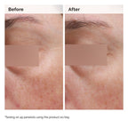 The Ordinary Niacinamide 5% Face and Body Emulsion — 100 ml — photo 3