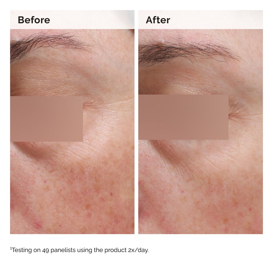 The Ordinary Niacinamide 5% Face and Body Emulsion — 100 ml — photo 3