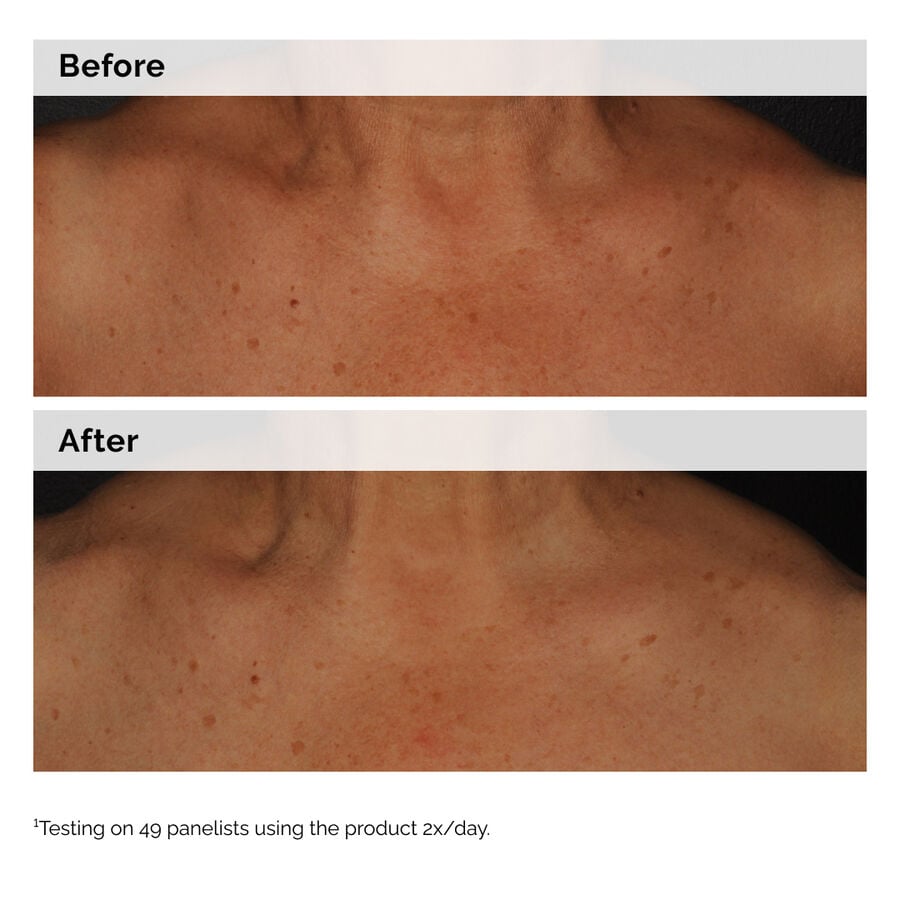 The Ordinary Niacinamide 5% Face and Body Emulsion — 100 ml — photo 2