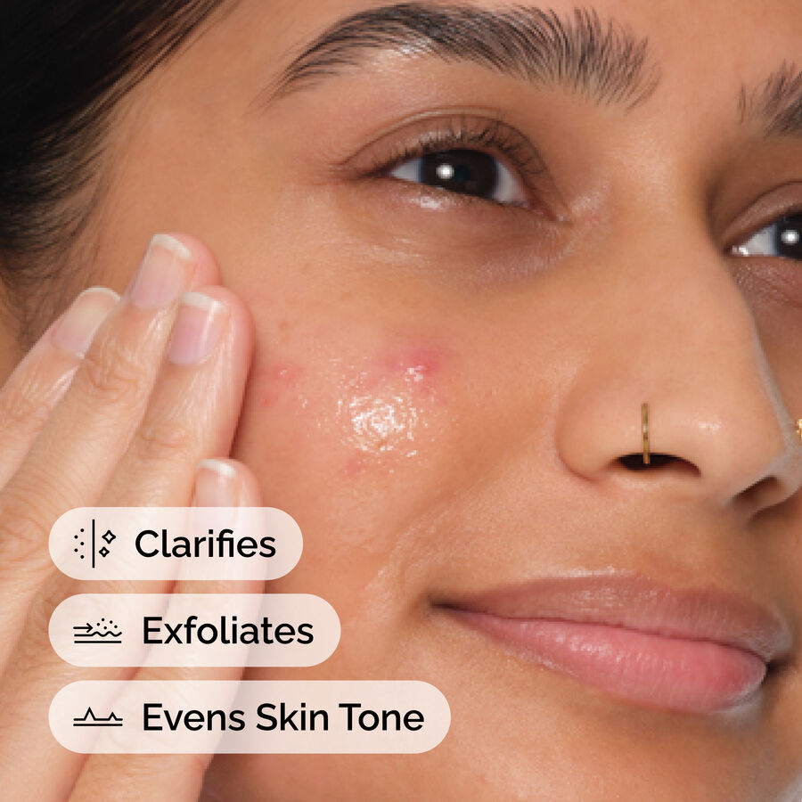 The Ordinary Salicylic Acid 2% Anhydrous Solution — 30 ml — photo 2