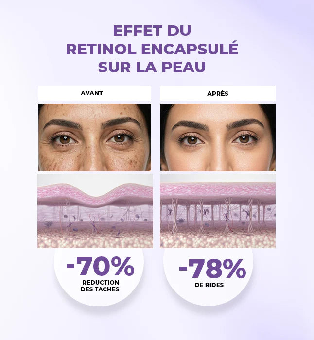 Gleamy Retinol Encapsule Regenerant 40ml