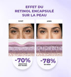 Gleamy Retinol Encapsule Regenerant 40ml